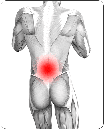 Lower Back Muscle Strain Treatment Symptoms and Causes