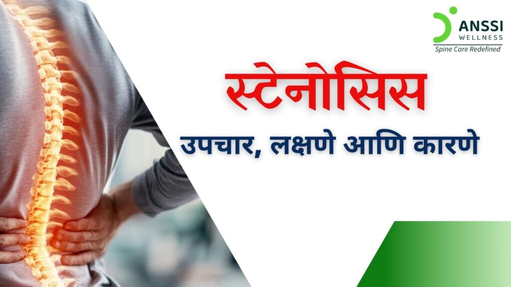 स्टेनोसिस: उपचार, लक्षणे आणि कारणे