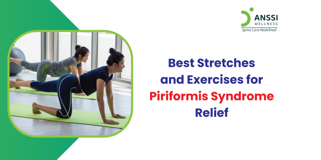 Piriformis Syndrome Stretches For Natural Pain Relief Piriformis Syndrome Stretches For Natural Pain Relief