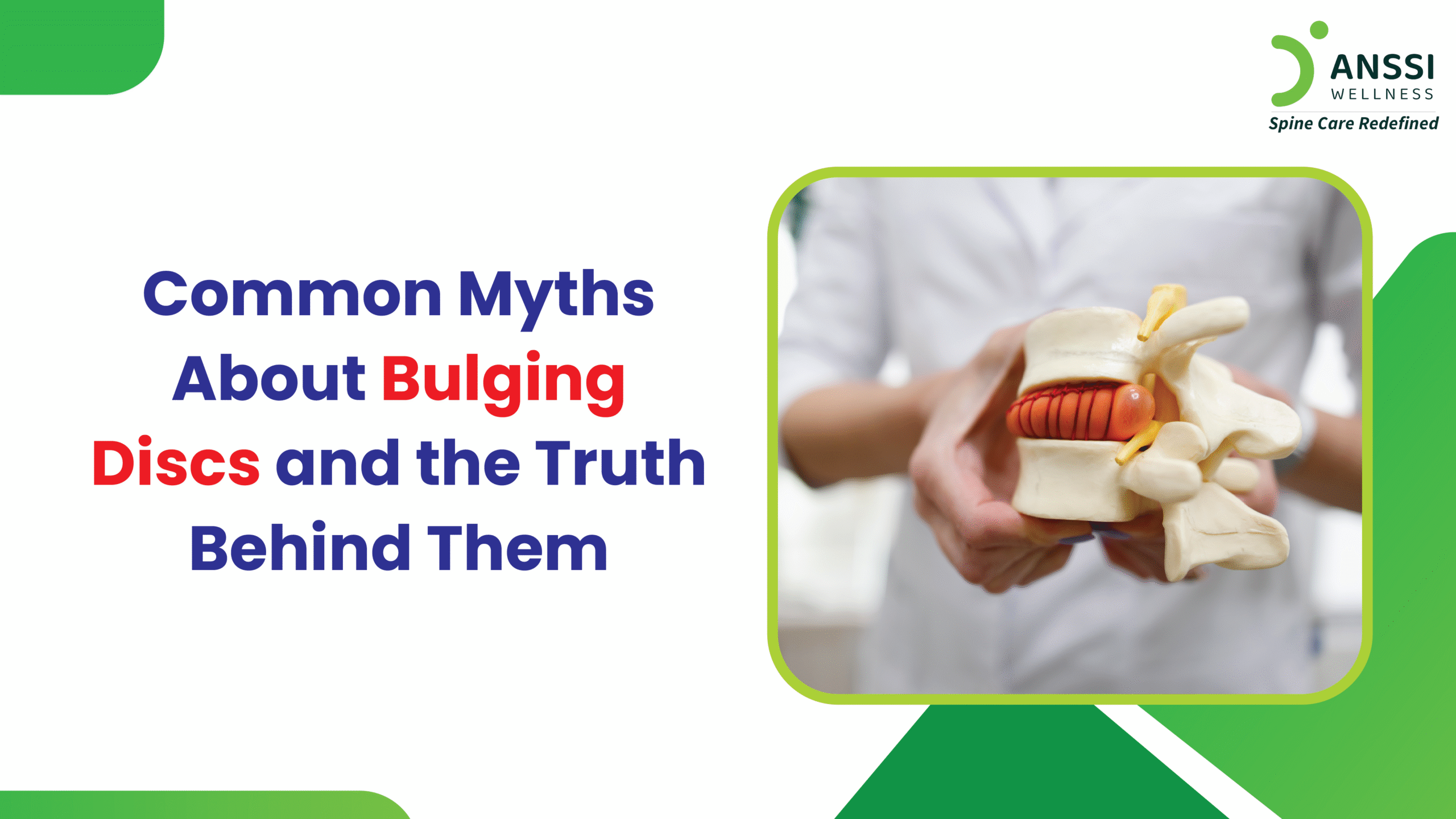 Bulging Disc Treatment: Myths, Facts & Non-Surgical Care