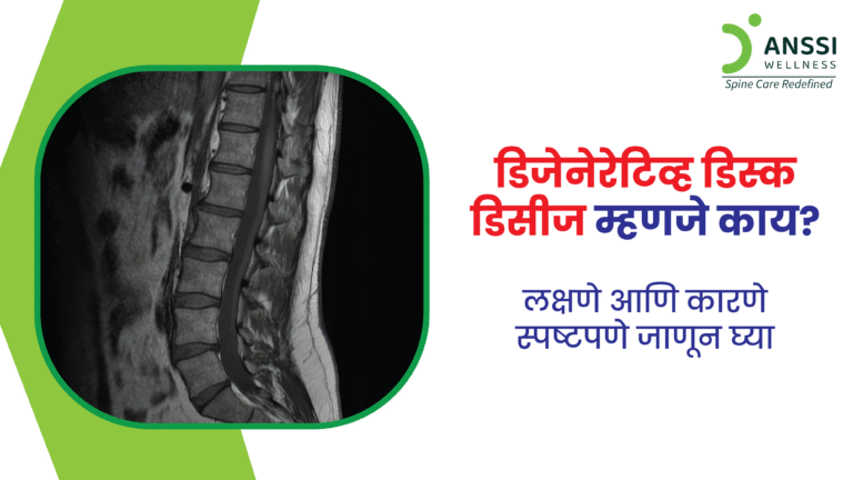 पाठदुखीमागे अनेक कारणे असू शकतात, परंतु डिजेनेरेटिव्ह डिस्क डिसीज (Degenerative Disc Disease) हे एक महत्त्वाचे आणि बहुतेक वेळा दुर्लक्षित असे कारण आहे.