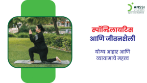 स्पॉन्डिलायटिस या स्थितीत मणक्याच्या सांध्यांमध्ये सूज येते आणि कण्याची हाडे एकमेकांशी जोडण्याची प्रक्रिया सुरू होते.