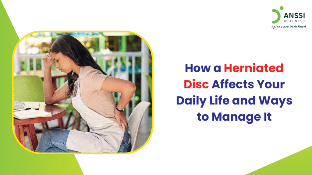 Herniated disc occurs when the soft, gel-like material inside the discs of your spine breaks through the outer layer.