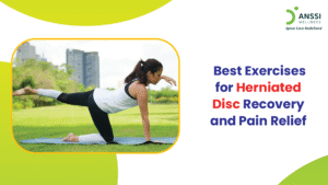 A herniated disc occurs when the soft inner portion of a spinal disc pushes through its outer layer, irritating nearby nerves.