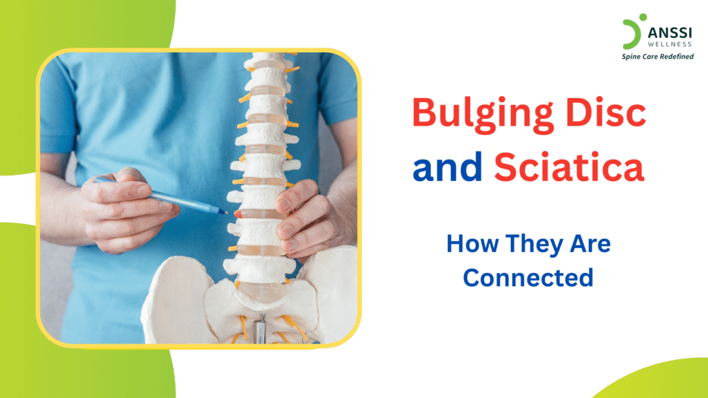 Back pain is one of the most common health concerns worldwide, and two conditions that are often linked are bulging discs and sciatica.