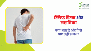 स्लिप डिस्क और साइटिका दोनों अलग-अलग स्थितियां हैं।