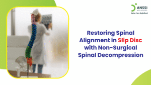 A slipped disc, also known as a herniated or prolapsed disc, is one of the most common causes of persistent back and neck pain today.