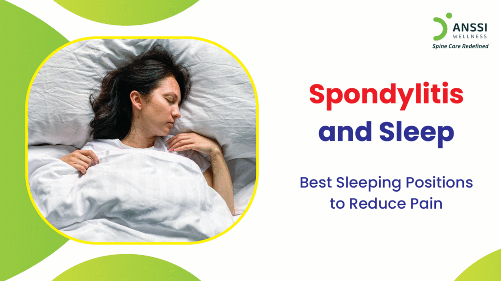 The persistent stiffness, inflammation, and back pain that accompany Spondylitis not only affect daily life but can also disrupt sleep patterns.