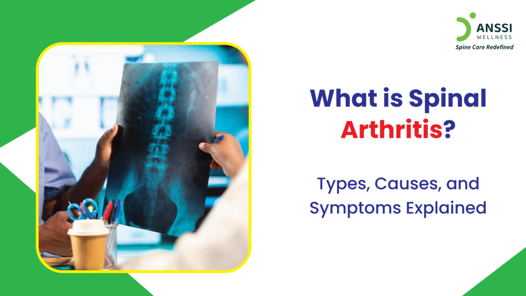 spinal arthritis leads to chronic pain, stiffness, and reduced mobility, often interfering with everyday activities like standing, walking, or even sitting.