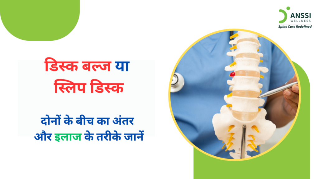 जब किसी कारण से इन डिस्क की संरचना बिगड़ती है, तब डिस्क बल्ज या स्लिप डिस्क जैसी समस्याएँ पैदा होती हैं।