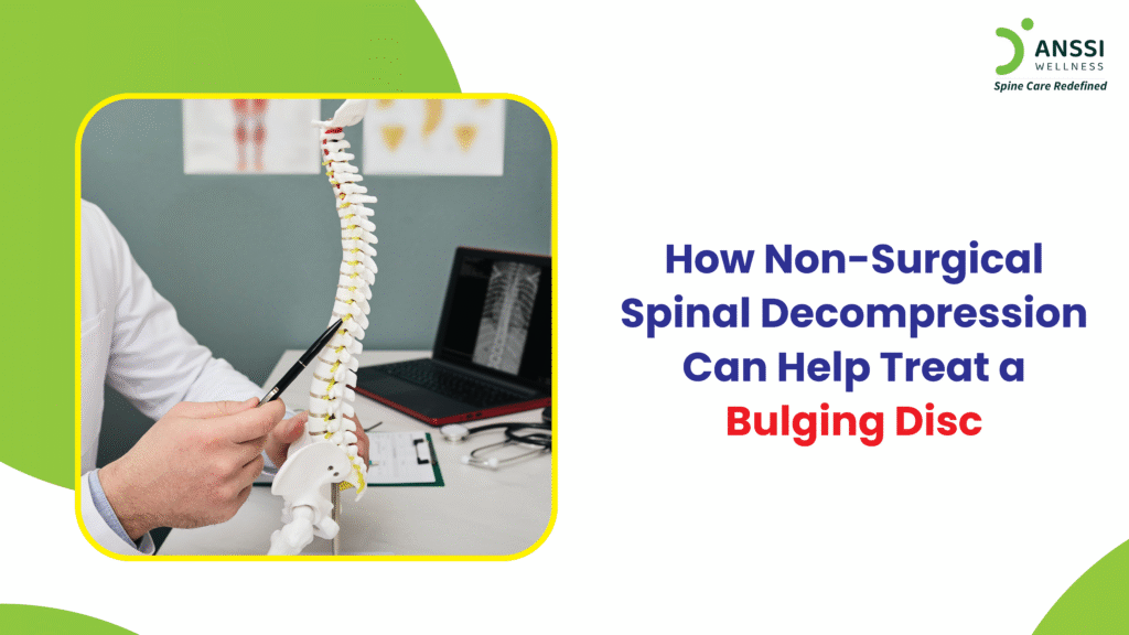 Although bulging disc is extremely common, many people misunderstand it, ignore early symptoms, or assume that surgery is the only solution.