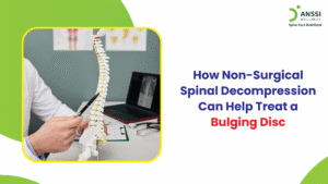 Although bulging disc is extremely common, many people misunderstand it, ignore early symptoms, or assume that surgery is the only solution.
