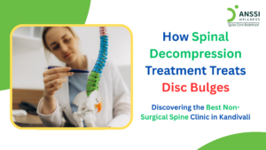 A disc bulge occurs when one of the spinal discs extends beyond its normal boundary due to pressure or degeneration.