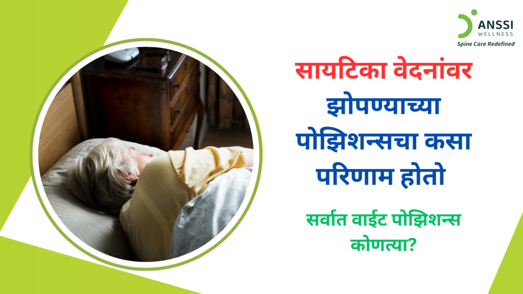 झोपण्याची मुद्रा योग्य नसेल, तर सायटिकाच्या वेदना अधिक तीव्र होऊ शकतात.