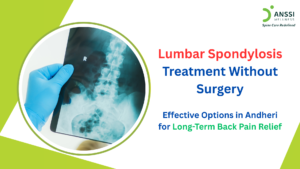 Lumbar spondylosis refers to age-related wear and tear of the discs and joints in the lower spine.