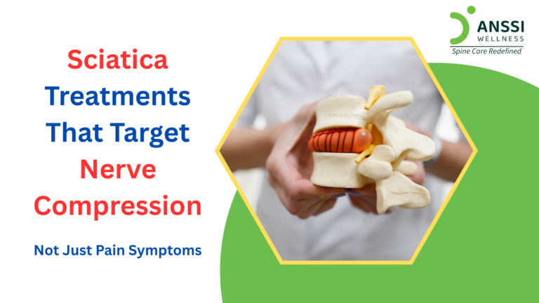 Sciatica occurs when the sciatic nerve becomes irritated or compressed, usually in the lower spine.