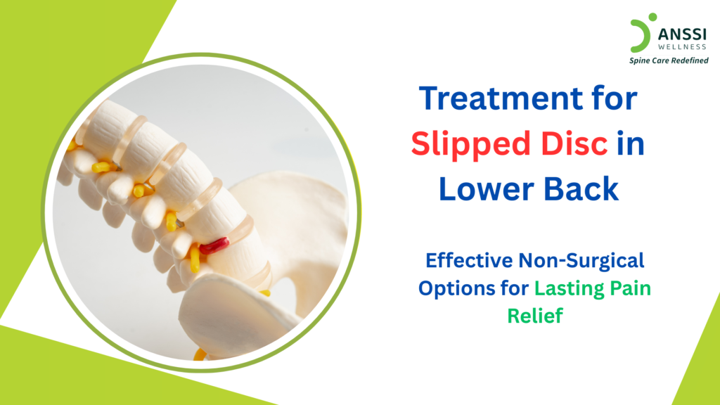 Lower back pain is one of the most common health issues affecting people today, and one of its major causes is a Slipped Disc.