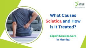 Unlike general back pain, which is often localised, sciatica is characterised by pain that spreads from the lower back to the leg.