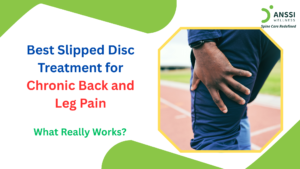 One of the leading causes behind persistent back and radiating leg pain is a slipped disc.