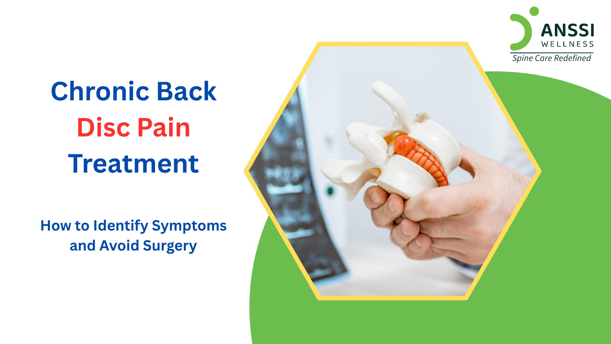 Chronic Back Disc Pain Treatment Without Surgery