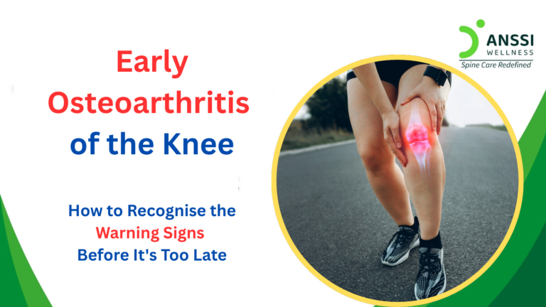 Osteoarthritis of the knee is not a death sentence for your mobility, but only if you catch it early.