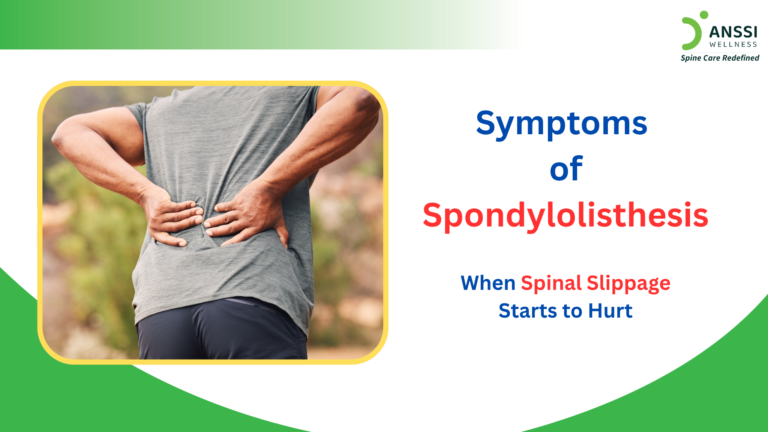 The severity of spondylolisthesis symptoms often corresponds to the degree of vertebral displacement and nerve involvement.