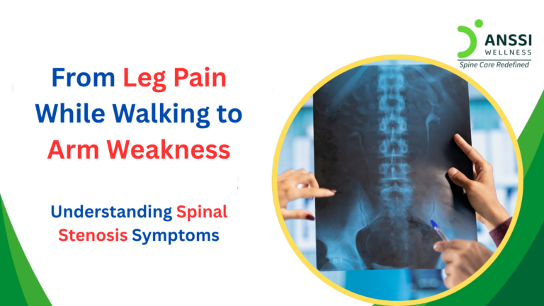 Spinal stenosis is a common age-related spinal condition that can gradually affect mobility, balance, and the overall quality of your life.