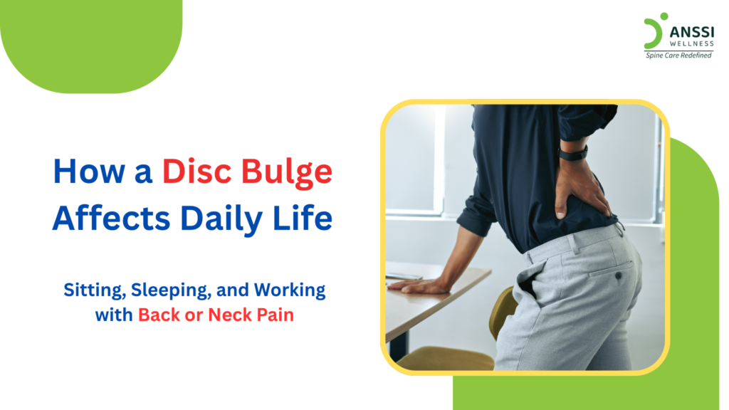 Depending on the location and severity, a disc bulge can produce pain, stiffness, numbness, or weakness.
