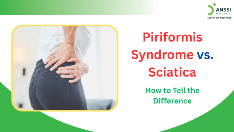 Pain that travels from the lower back down the leg is commonly assumed to be sciatica. However, not every case of radiating leg pain originates from the spine.