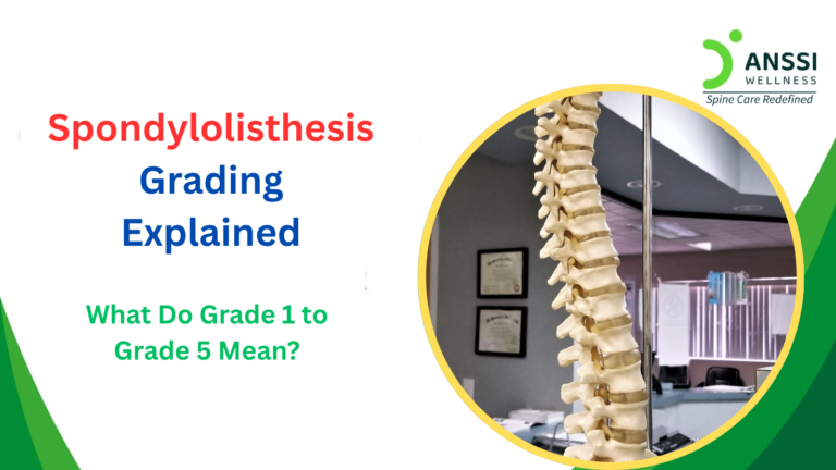 Spondylolisthesis is a spinal condition in which one vertebra slips forward over the vertebra below it.