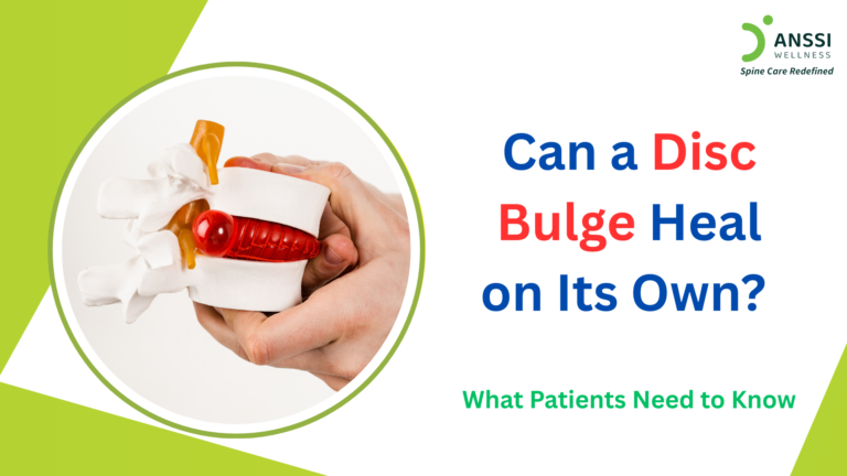 “Can a disc bulge heal on its own?” is one of the most common questions asked by people after seeing a disc bulge mentioned in their MRI report.