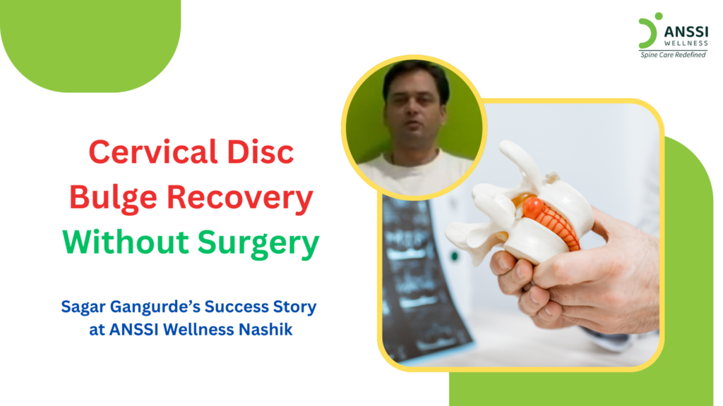 Mr. Gangurde was diagnosed with a C2-C3 diffuse disc bulge, which was associated with symptoms of cervical radiculopathy.