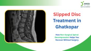 For many residents of Ghatkopar, persistent back pain, numbness, tingling, or weakness eventually leads to an MRI scan, which often reveals a slipped disc, also known as a disc herniation.