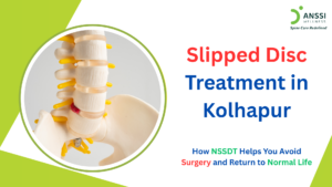 A slipped disc, also called a herniated disc, can develop when the outer portion of an intervertebral disc becomes weakened or damaged, allowing its inner material to protrude.