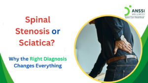 Leg pain, tingling, numbness, and difficulty walking are often described as “sciatica.” But these symptoms can have several different causes.