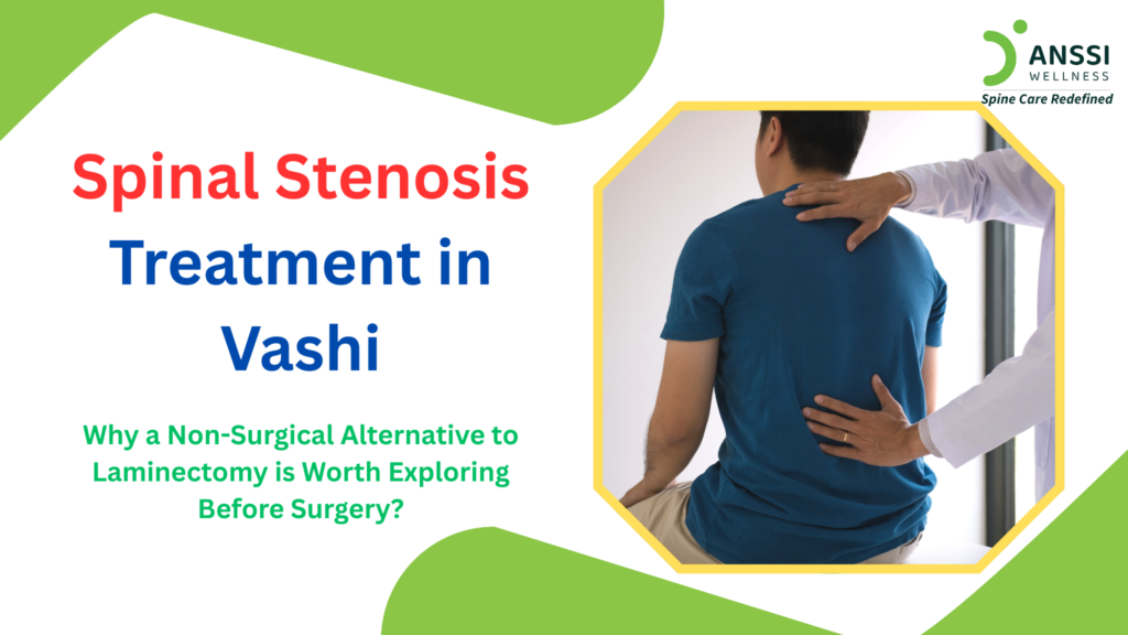 For residents of Vashi and Navi Mumbai who have been diagnosed with lumbar spinal stenosis, being advised to undergo laminectomy or spinal fusion can raise an important question: Is surgery my only option?