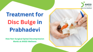 A disc bulge is a common spinal condition that can cause persistent back or neck pain, stiffness, tingling, numbness, or pain that travels into the arms or legs.