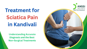 Sciatica refers to pain associated with irritation or compression of the sciatic nerve or its nerve roots in the lower spine.
