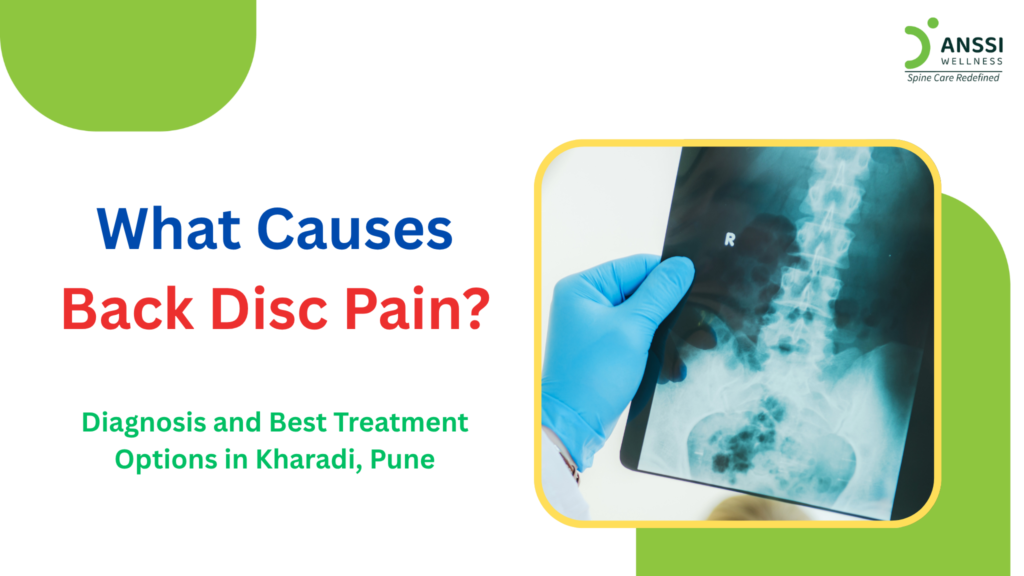 Problems involving the intervertebral discs can become an important source of persistent, recurring, or radiating back pain.