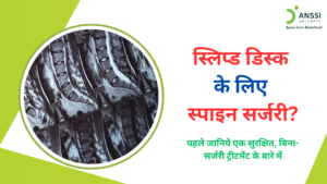 जब जाँच में स्लिप्ड डिस्क का पता चलता है और रीढ़ की सर्जरी की सलाह दी जाती है, तो मरीजों के मन में कई सवाल उठते हैं।