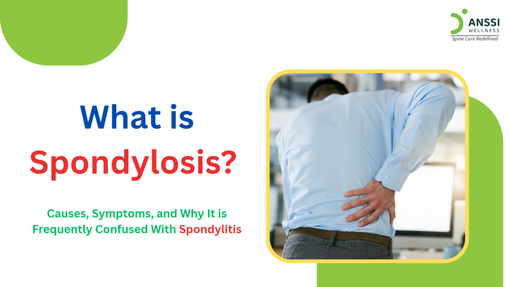 Spondylosis and spondylitis have different underlying causes and may require different treatment approaches.