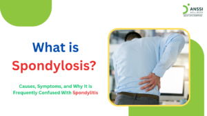 Spondylosis and spondylitis have different underlying causes and may require different treatment approaches.